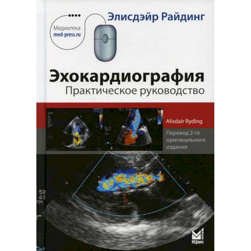 Эхокардиография