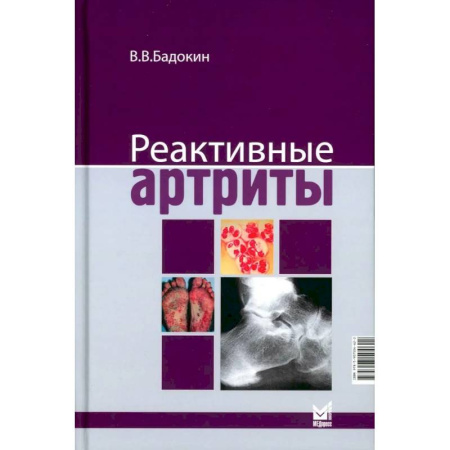 Медицинские энциклопедии и справочники, книга Реактивные артриты. Урогенитальные и постэнтероколитические купить по скидке