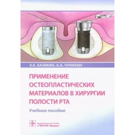Стоматология, книга Применение остеопластических материалов в хирургии полости рта купить по скидке