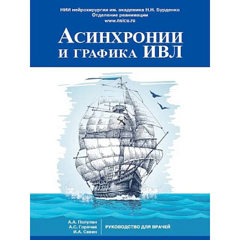 Асинхронии и графика ИВЛ