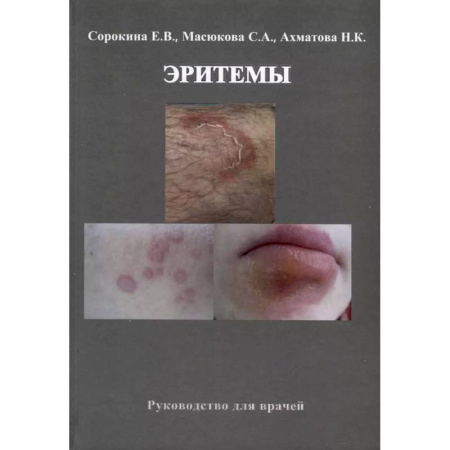 Кожные и венерические болезни, книга Эритемы. Руководство для врачей купить по скидке