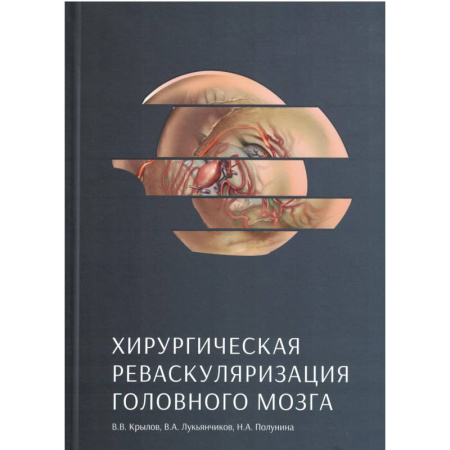 Медицинские энциклопедии и справочники, книга Хирургическая реваскуляризация головного мозга купить по скидке