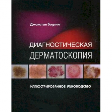 Кожные и венерические болезни, книга Диагностическая дерматоскопия. Иллюстрированное руководство купить по скидке