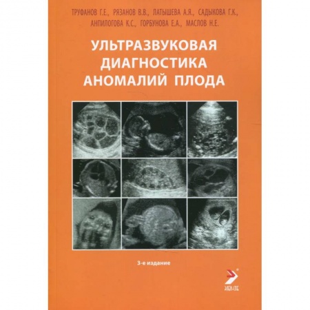 Акушерство и гинекология, книга Ультразвуковая диагностика аномалий плода: Руководство для врачей купить по скидке