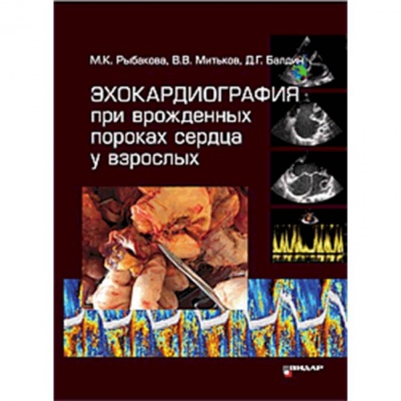 Кардиология, книга Эхокардиография при врожденных пороках сердца у взрослых купить по скидке